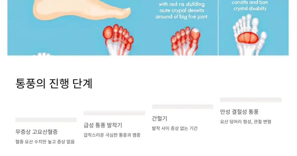 통풍 예방 관리 방법05 무증상부터 만성까지, 통풍의 단계별 진행 양상